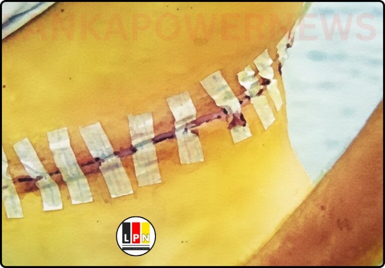 කරාපිටිය ශික්‍ෂණ රෝහල  වකුගඩු ජාවාරම්කරුවන් ගේ ග්‍රහණයට..!